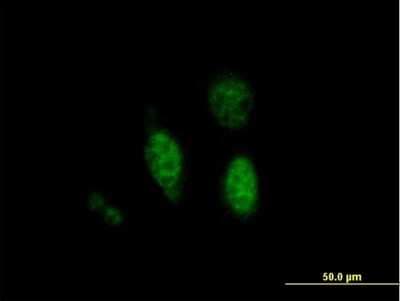 Immunocytochemistry/ Immunofluorescence: BDP1 Antibody [H00026469-B01P]