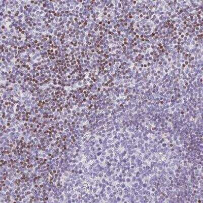 Immunohistochemistry-Paraffin: BEND2 Antibody [NBP1-85372]