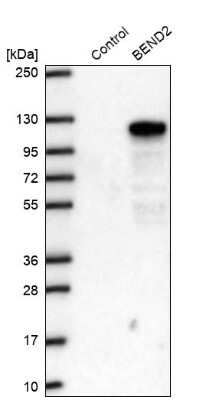 Western Blot: BEND2 Antibody [NBP2-38127]