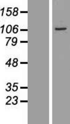 Western Blot: BEND2 Overexpression Lysate [NBL1-09637]