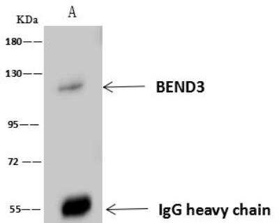 Immunoprecipitation: BEND3 Antibody [NBP3-12571]