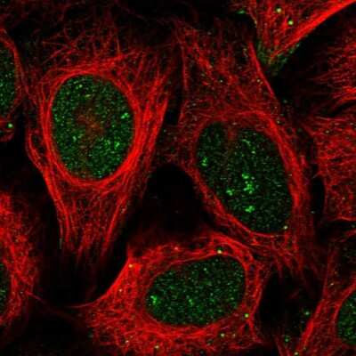 Immunocytochemistry/ Immunofluorescence: BEND7 Antibody [NBP1-89913]