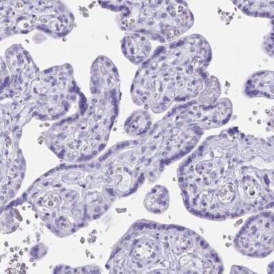 Immunohistochemistry-Paraffin: BEX5 Antibody [NBP2-32422]
