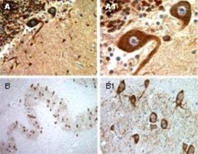 Immunohistochemistry-Paraffin: BFAR Antibody [NB100-56094]