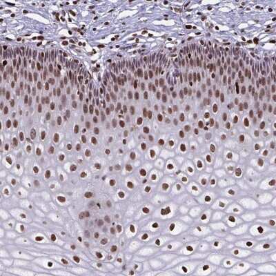 Immunohistochemistry-Paraffin: BHLHA9 Antibody [NBP2-37997]