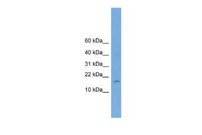 Western Blot: BHLHA9 Antibody [NBP2-82749]