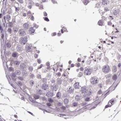 Immunohistochemistry-Paraffin: BHLHB5 Antibody [NBP2-39016]