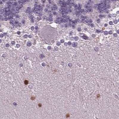 Immunohistochemistry-Paraffin: BHLHB5 Antibody [NBP2-39016]