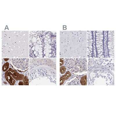 Immunohistochemistry-Paraffin: BHMT Antibody [NBP1-88611]