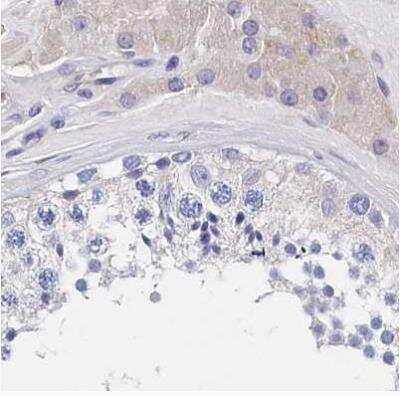 Immunohistochemistry-Paraffin: BHMT Antibody [NBP1-88611]