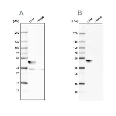 Western Blot: BHMT Antibody [NBP1-88611]