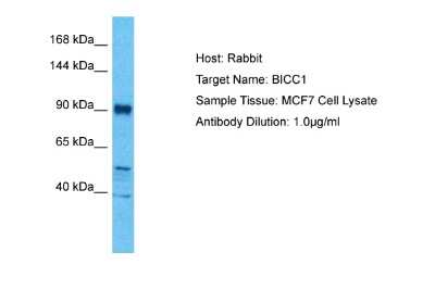 Western Blot: BICC1 Antibody [NBP2-82763]