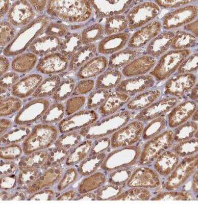 Immunohistochemistry-Paraffin: BICD1 Antibody [NBP1-85843]