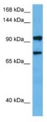 Western Blot: BICD1 Antibody [NBP3-10679]