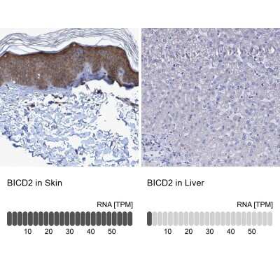 Immunohistochemistry-Paraffin: BICD2 Antibody [NBP1-81488]