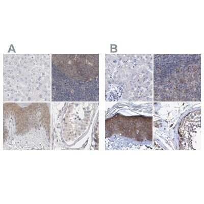 Immunohistochemistry-Paraffin: BICD2 Antibody [NBP1-81489]