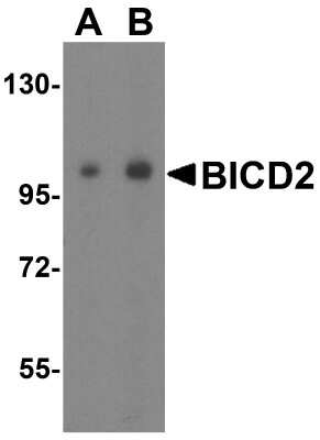 Western Blot: BICD2 AntibodyBSA Free [NBP2-81961]
