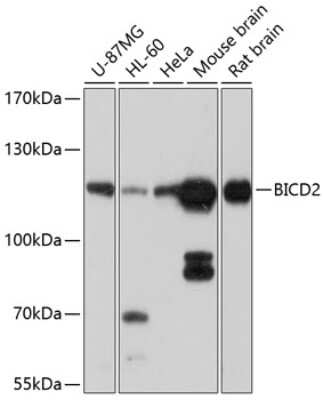 Western Blot: BICD2 AntibodyBSA Free [NBP2-91999]