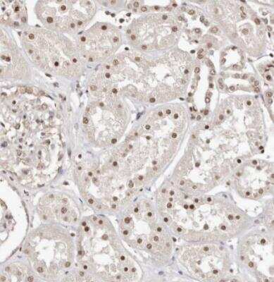 Immunohistochemistry-Paraffin: BICRAL Antibody [NBP1-86360]