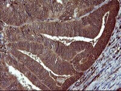 Immunohistochemistry: BID Antibody (OTI1G10) - Azide and BSA Free [NBP2-70254]