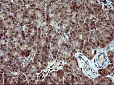 Immunohistochemistry: BID Antibody (OTI1G10) - Azide and BSA Free [NBP2-70254]