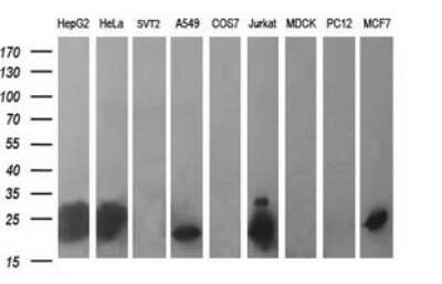 Western Blot: BID Antibody (OTI1G10) [NBP2-46575]