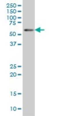 Western Blot: BIN1 Antibody (1H1) [H00000274-M01]