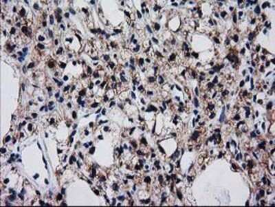 Immunohistochemistry-Paraffin: BIN3 Antibody (OTI8E9) [NBP2-03389]