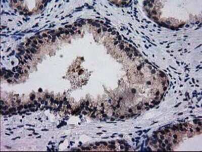 Immunohistochemistry: BIN3 Antibody (OTI8E9) - Azide and BSA Free [NBP2-72051]