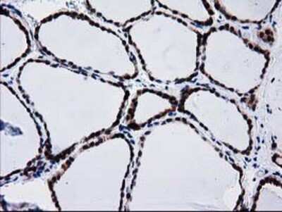 Immunohistochemistry: BIN3 Antibody (OTI8E9) - Azide and BSA Free [NBP2-72051]