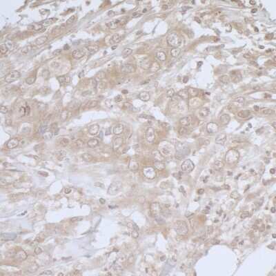 Immunohistochemistry-Paraffin: BIRC6 Antibody [NB300-264]