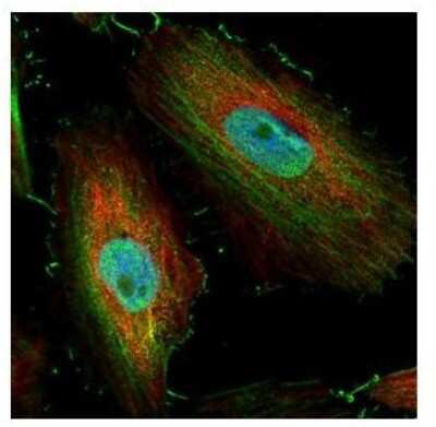 Immunocytochemistry/ Immunofluorescence: BIVM Antibody [NBP1-31214]