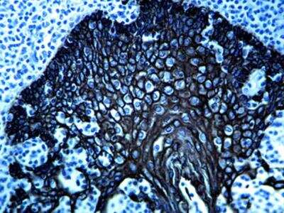 Immunohistochemistry-Paraffin: BLACK HRP Staining Kit (Colorimetric) [NBP3-12183]