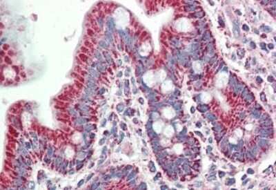 Immunohistochemistry-Paraffin: BLAME/SLAMF8 Antibody [NBP2-26110]