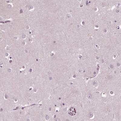 Immunohistochemistry-Paraffin: BLAME/SLAMF8 Antibody [NBP2-56595]