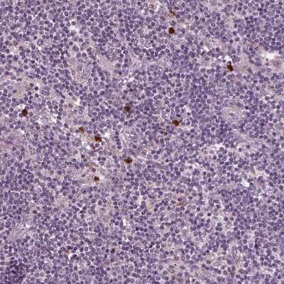 Immunohistochemistry-Paraffin: BLAME/SLAMF8 Antibody [NBP2-56595]