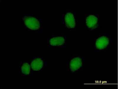 Immunocytochemistry/ Immunofluorescence: BLAP75 Antibody [H00080010-B02P]