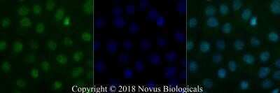 Immunocytochemistry/ Immunofluorescence: BLIMP1/PRDM1 Antibody (3H2-E8) - Azide and BSA Free [NBP2-80597]