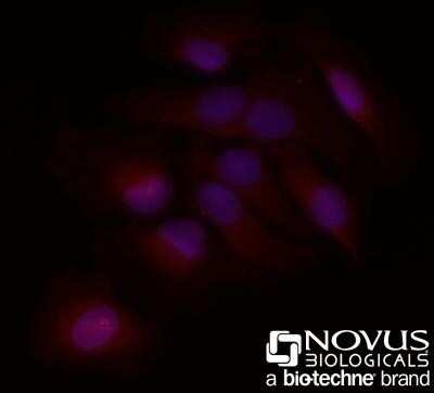 Immunocytochemistry/ Immunofluorescence: BLIMP1/PRDM1 Antibody (3H2-E8) - Azide and BSA Free [NBP2-80597]