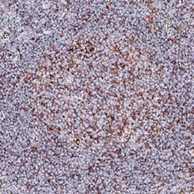 Immunohistochemistry: BLIMP1/PRDM1 Antibody (3H2-E8) - Azide and BSA Free [NBP2-80597]