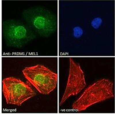 Immunofluorescence: BLIMP1/PRDM1 Antibody [NBP1-51991]