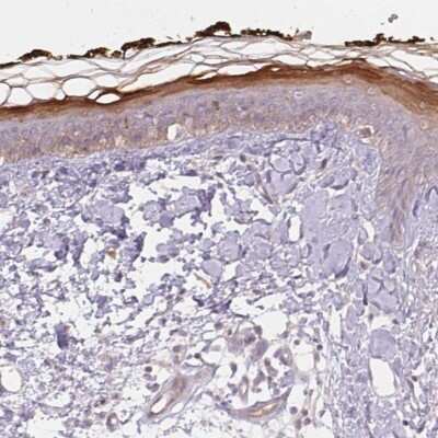 Immunohistochemistry-Paraffin: BLMH/Bleomycin Hydrolase Antibody [NBP2-39023]