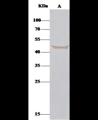 Immunoprecipitation: BLMH/Bleomycin Hydrolase Antibody [NBP2-98334]