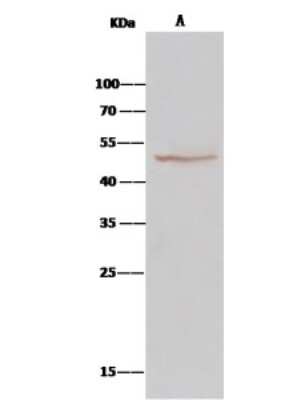 Immunoprecipitation: BLMH/Bleomycin Hydrolase Antibody [NBP2-99780]