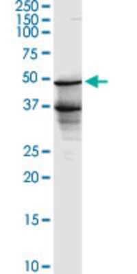 Western Blot: BLNK Antibody (1D7) [H00029760-M04]