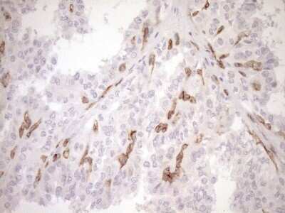 Immunohistochemistry: BLNK Antibody (OTI4C9) [NBP2-46577]