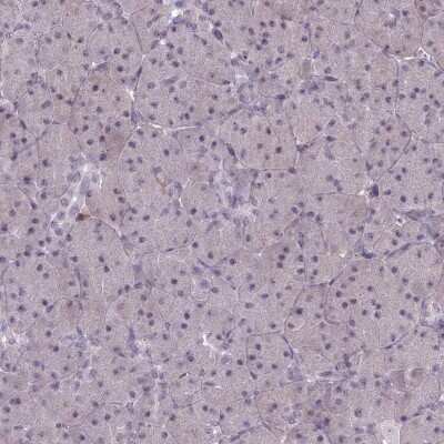 Immunohistochemistry-Paraffin: BLNK Antibody [NBP2-14356]