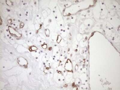 Immunohistochemistry: BLNK Antibody (OTI4C9) - Azide and BSA Free [NBP2-71855]