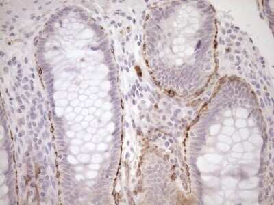 Immunohistochemistry: BLNK Antibody (OTI4C9) - Azide and BSA Free [NBP2-71855]