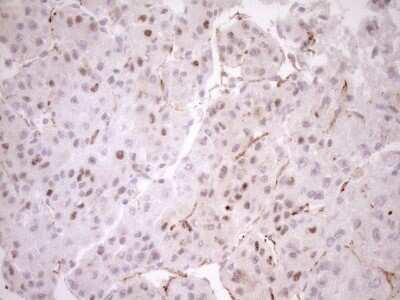 Immunohistochemistry: BLNK Antibody (OTI4C9) - Azide and BSA Free [NBP2-71855]